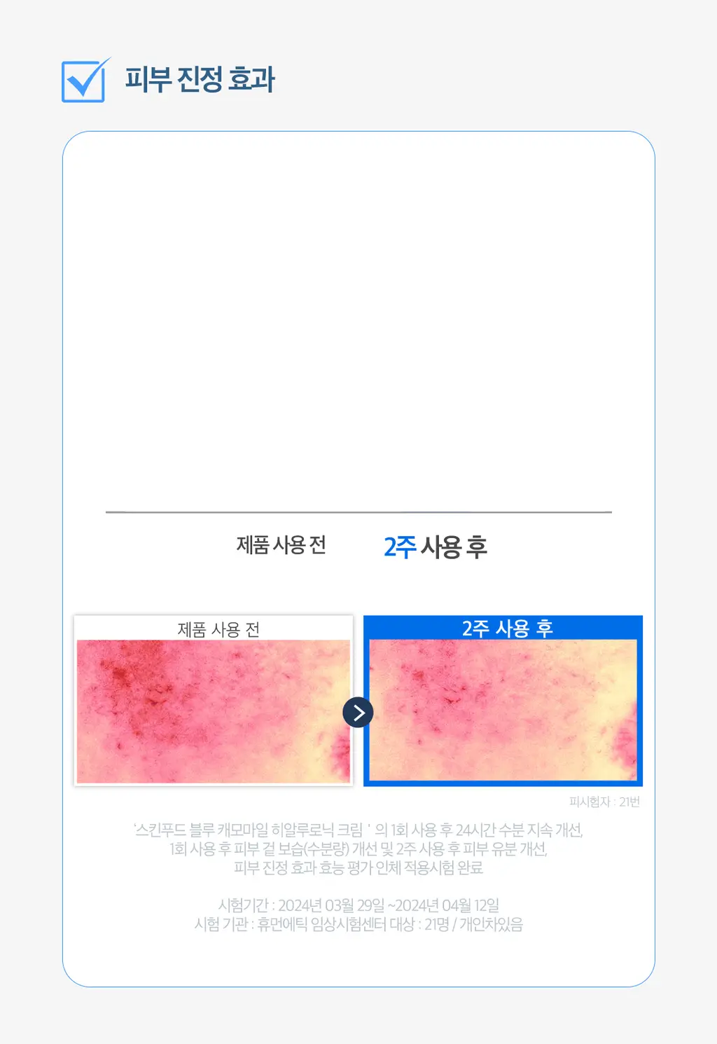 [쫀득물착크림] 스킨푸드 블루 캐모마일 히알루로닉 수분크림 기획(70ml+30ml) 상세페이지 22